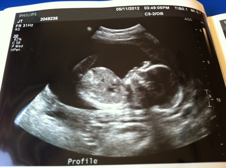 ultrasound, baby, pregnant
